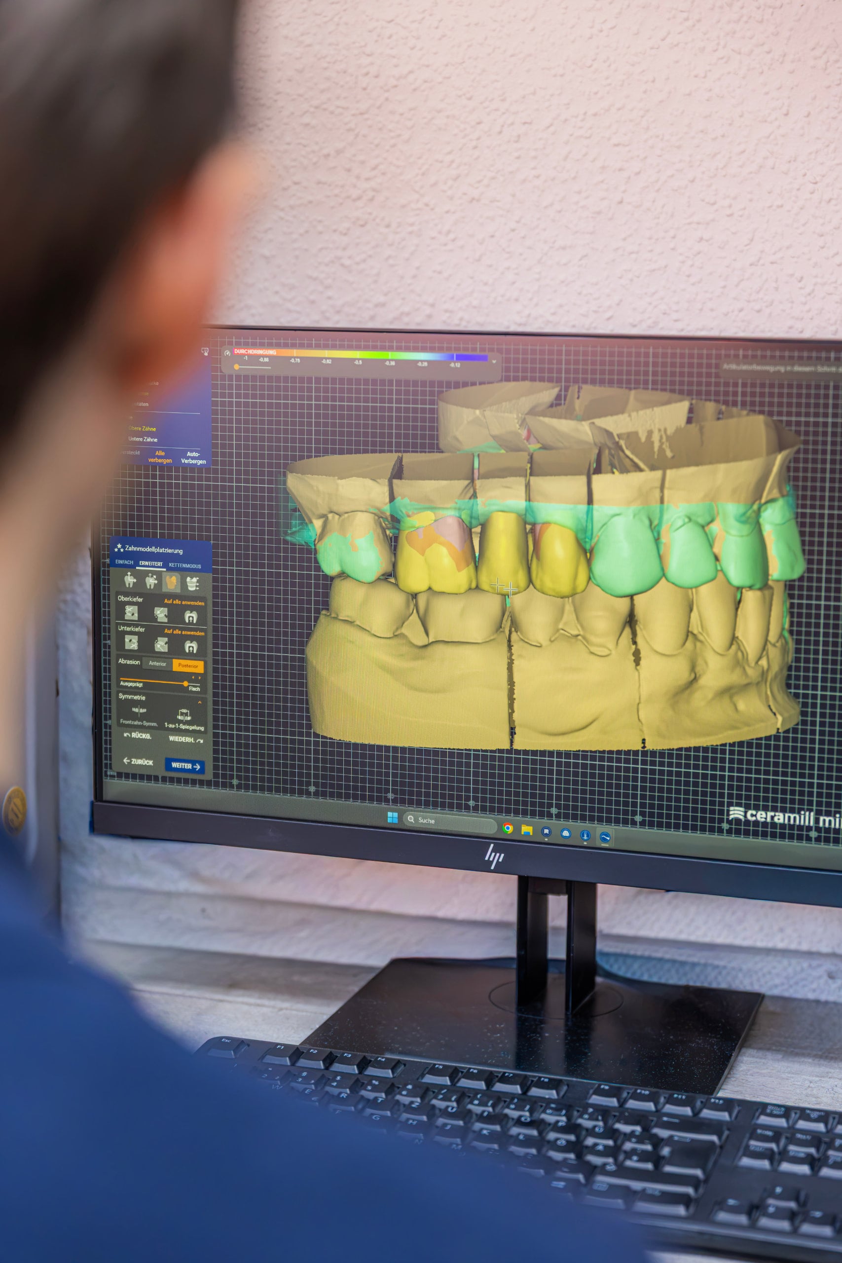 muehe-dentallabor_32